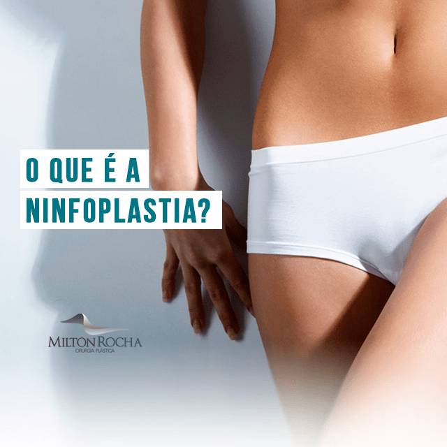 No momento, você está visualizando O que é a ninfoplastia?