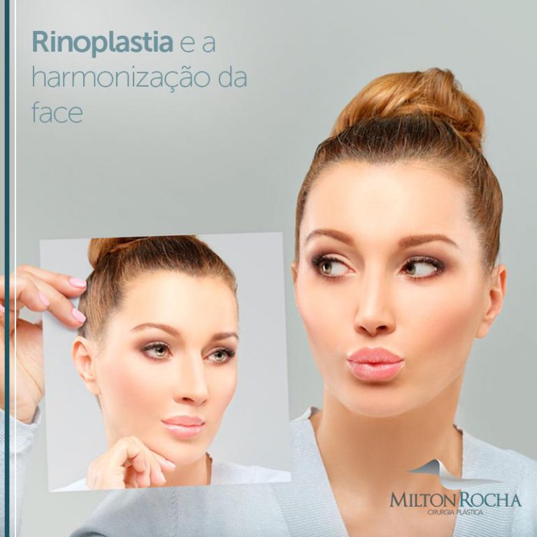 Leia mais sobre o artigo Rinoplastia e a harmonização da face