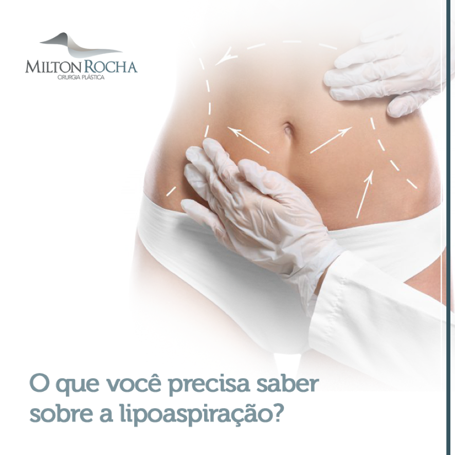 Leia mais sobre o artigo O que você precisa saber sobre a lipoaspiração?