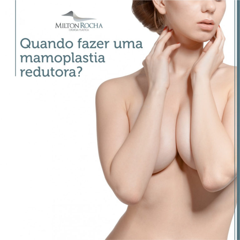 Leia mais sobre o artigo Quando fazer uma mamoplastia redutora?