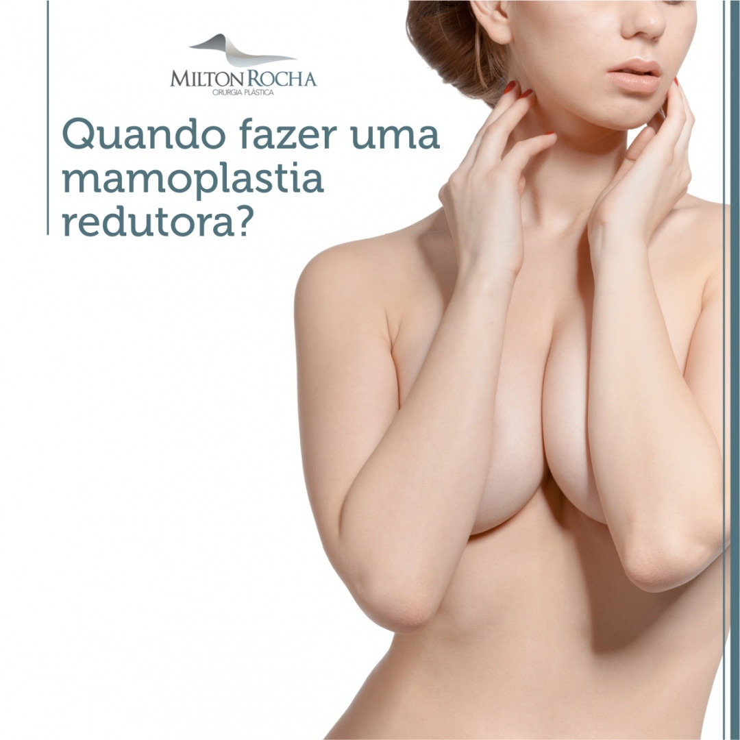 No momento, você está visualizando Quando fazer uma mamoplastia redutora?