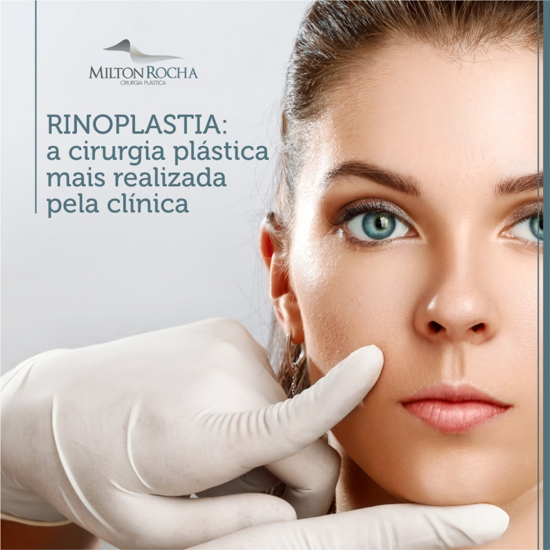 No momento, você está visualizando Rinoplastia: a cirurgia plástica mais realizada pela clínica