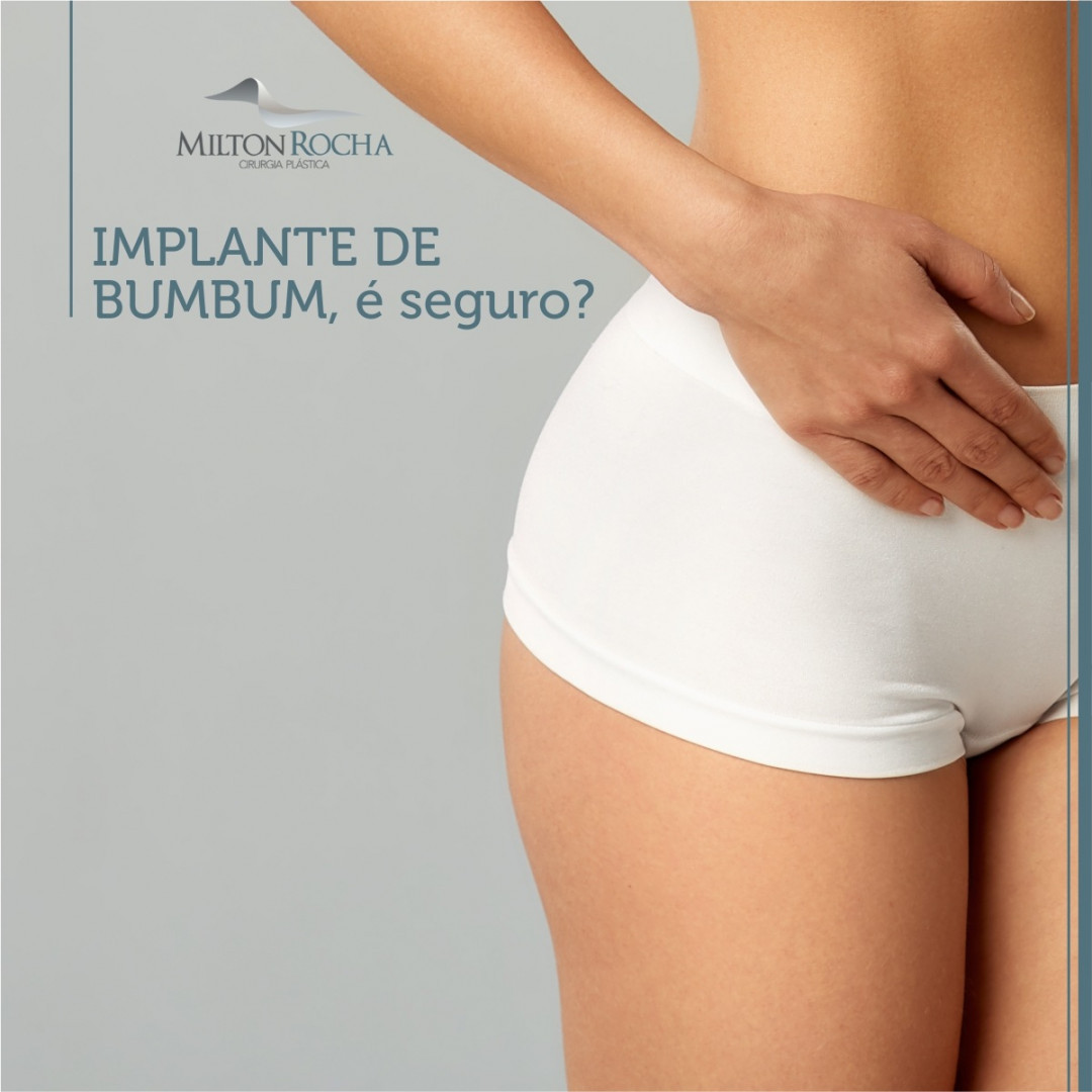 No momento, você está visualizando Implante de bumbum, é seguro?