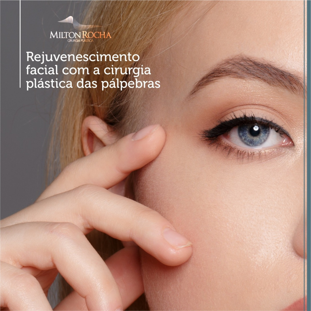 No momento, você está visualizando Rejuvenescimento facial com a cirurgia plástica das pálpebras