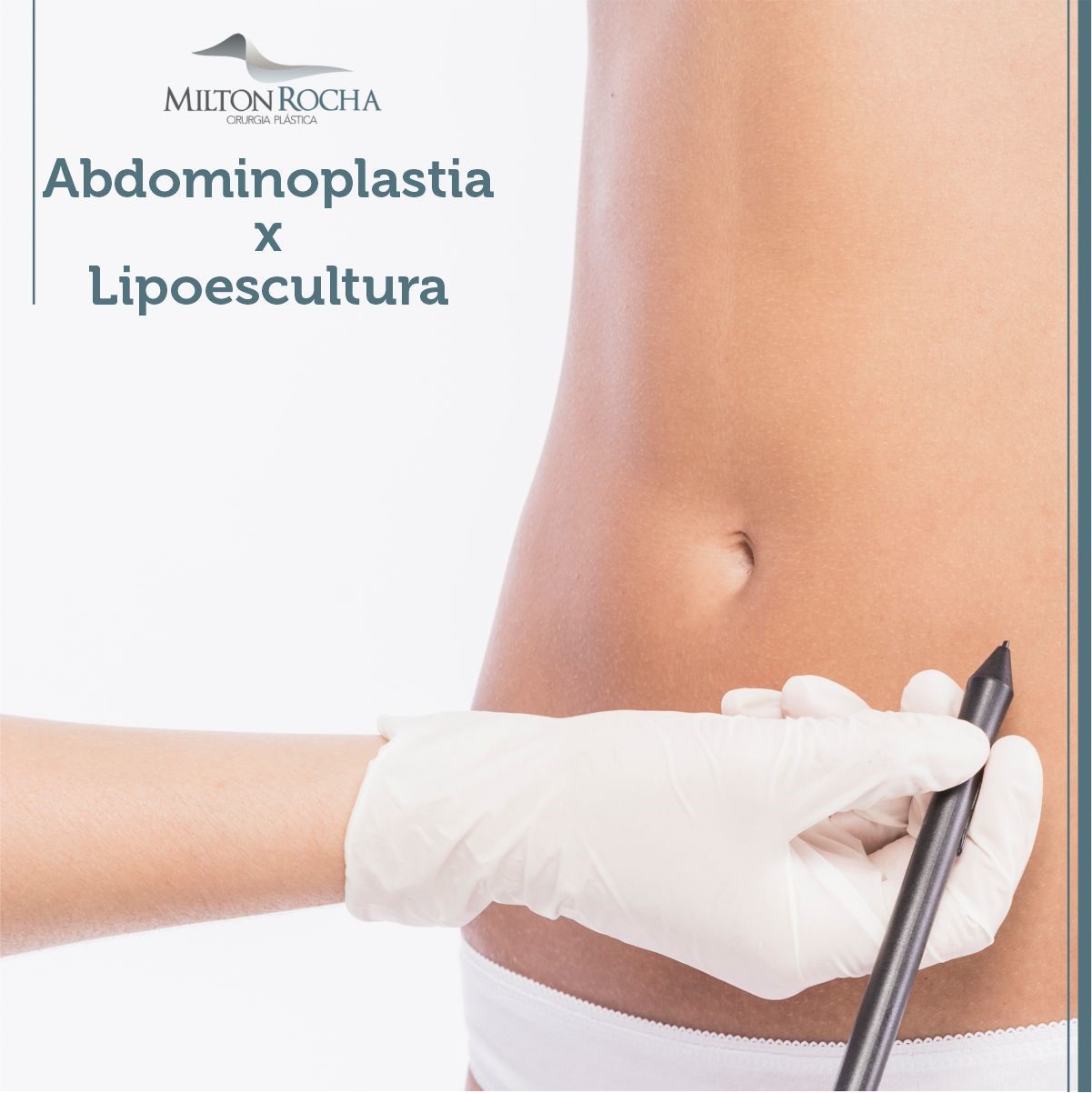 No momento, você está visualizando ABDOMINOPLASTIA X LIPOESCULTURA