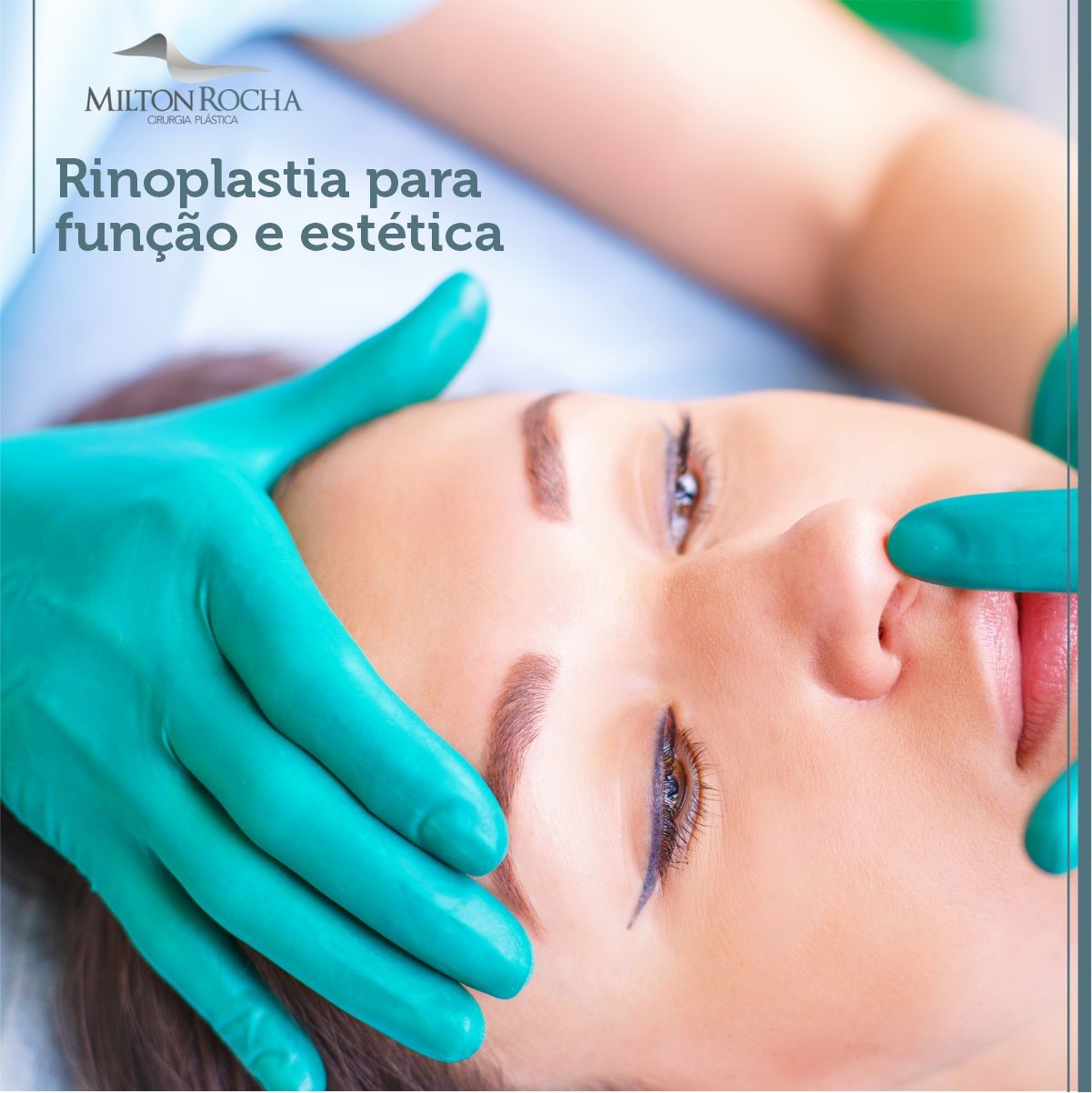 No momento, você está visualizando RINOPLASTIA PARA FUNÇÃO E ESTÉTICA