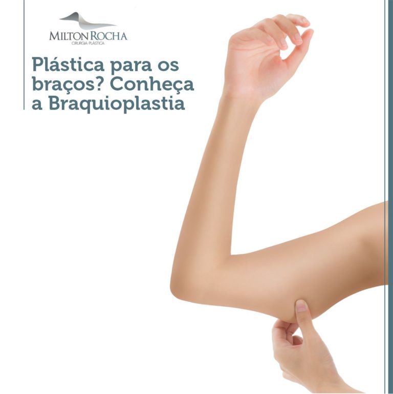 Leia mais sobre o artigo Plástica para os braços? Conheça a Braquioplastia