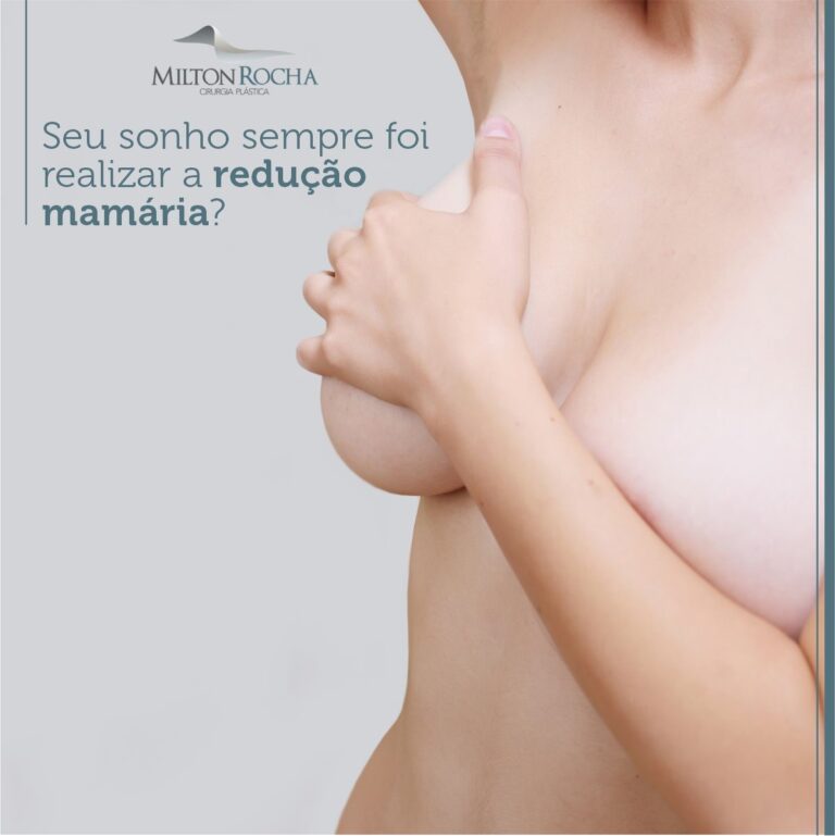 Leia mais sobre o artigo Seu sonho sempre foi realizar a redução mamária?