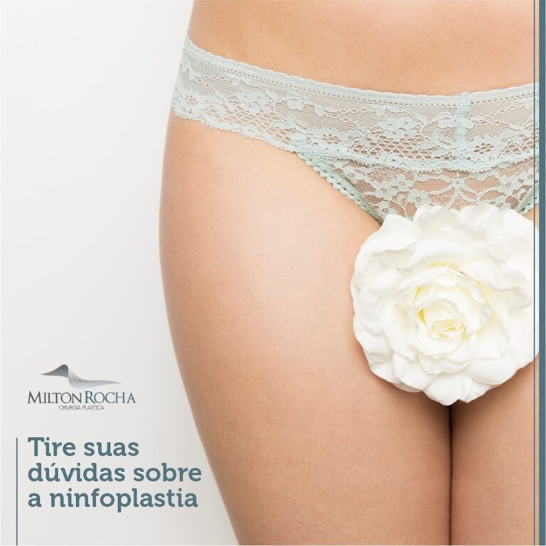 Leia mais sobre o artigo Cirurgia Plástica Recife – Ninfoplastia – Tire suas dúvidas sobre a ninfoplastia.