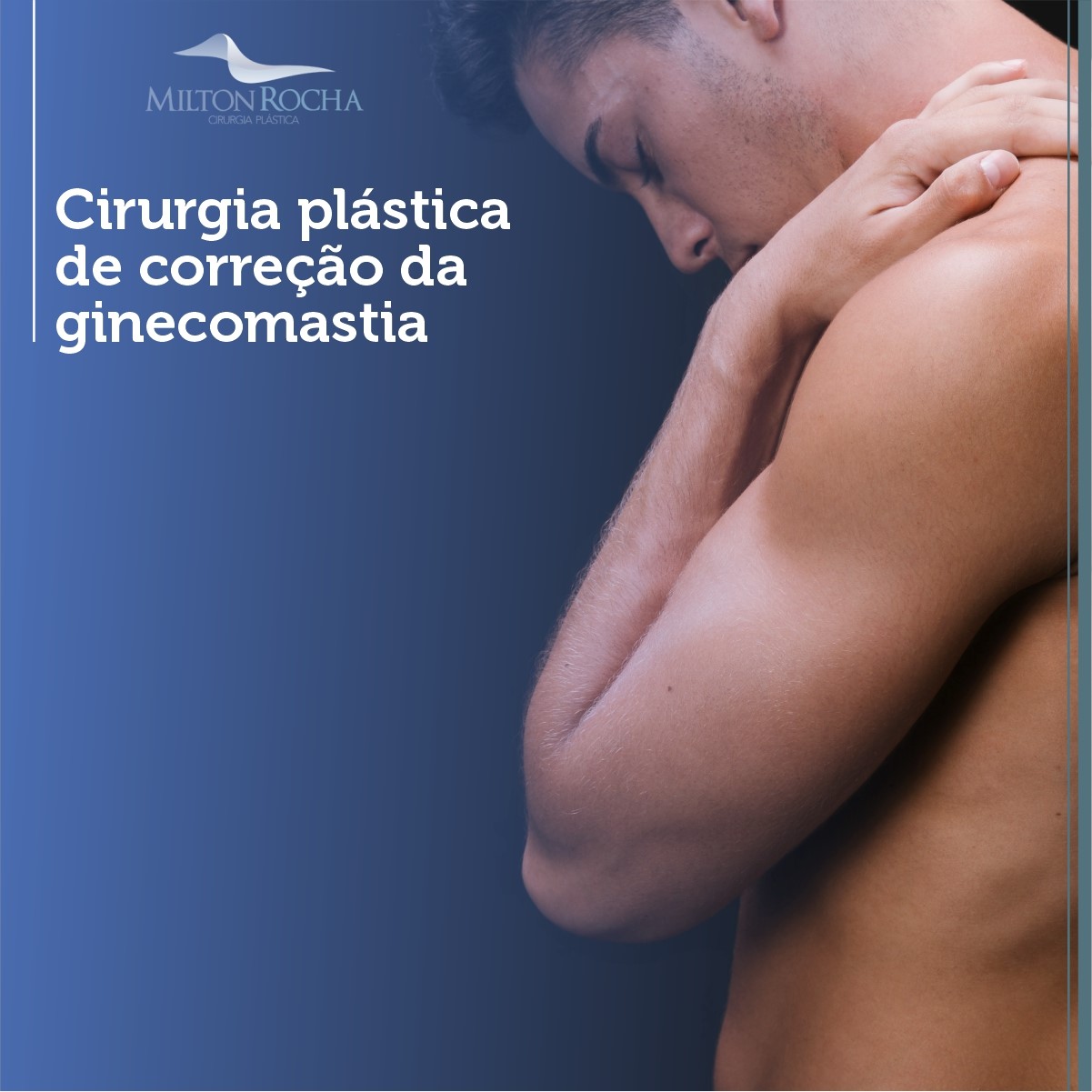No momento, você está visualizando Cirurgia Plástica Recife – Ginecomastia – Cirurgia Plástica de correção da ginecomastia.