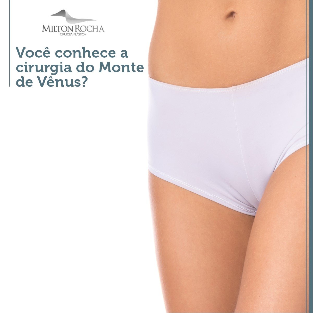 No momento, você está visualizando Você conhece a cirurgia do Monte de Vênus?