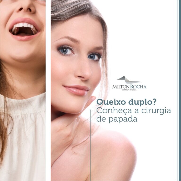 Leia mais sobre o artigo Queixo duplo? Conheça a cirurgia de papada