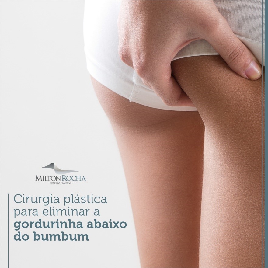 No momento, você está visualizando Cirurgia Plástica Recife – Cirurgia plástica para eliminar a gordurinha abaixo do bumbum