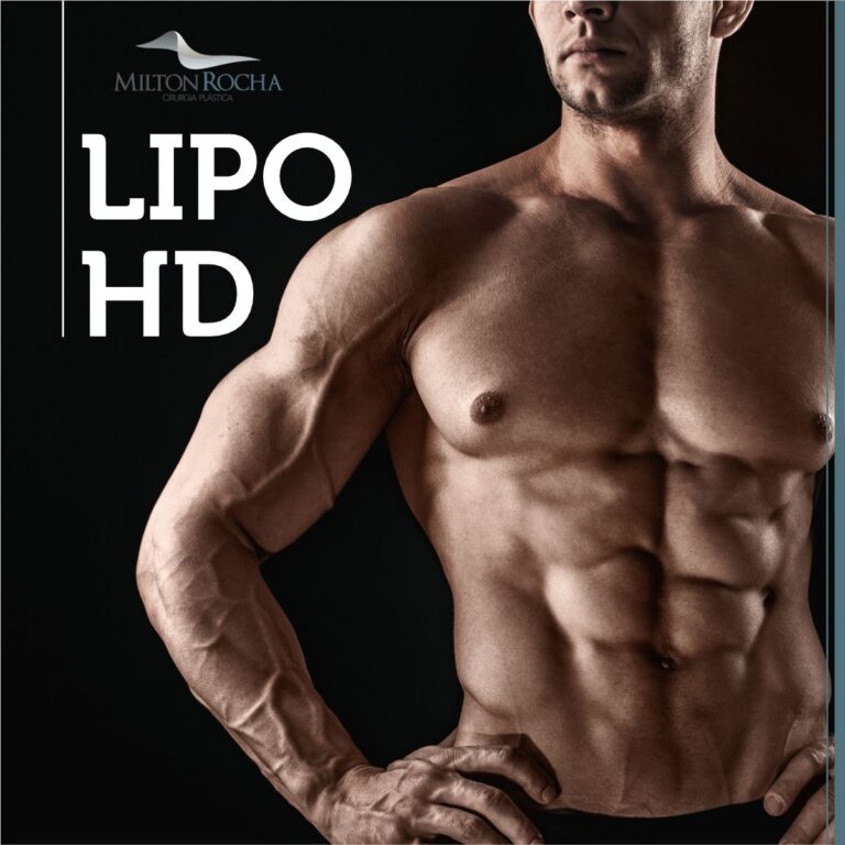 Leia mais sobre o artigo Cirurgia Plástica Recife – Lipo HD