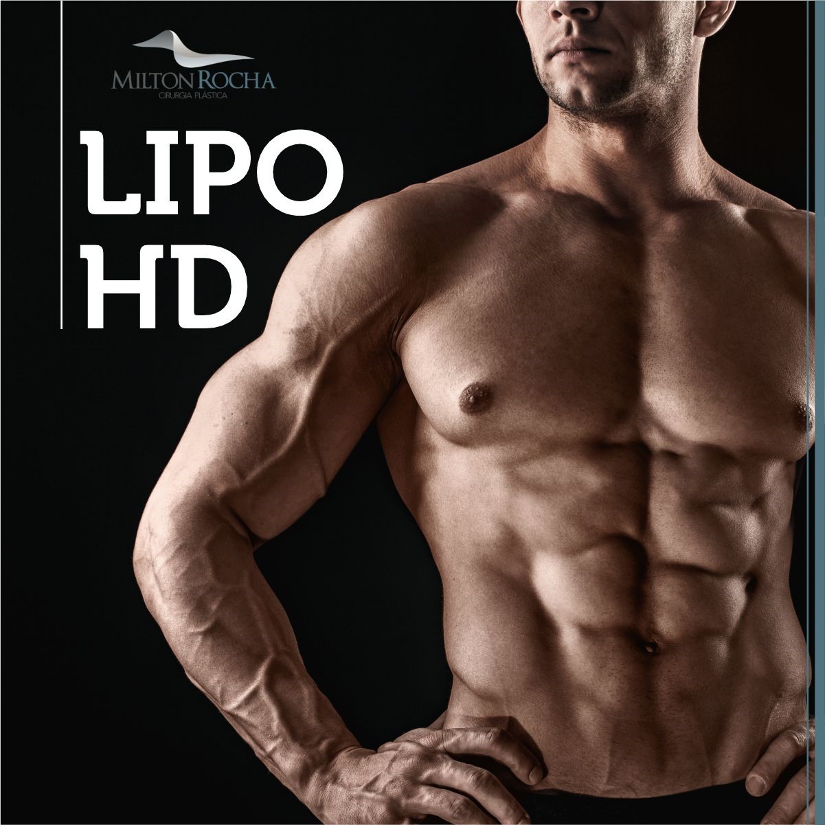 No momento, você está visualizando Cirurgia Plástica Recife – Lipo HD