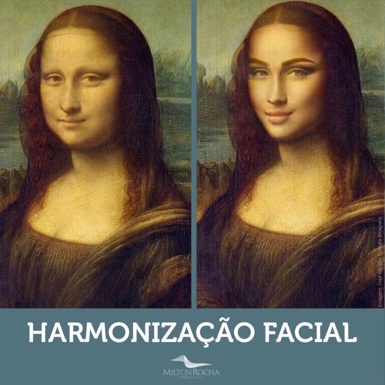 Leia mais sobre o artigo Cirurgia Plástica Recife – Harmonização Facial