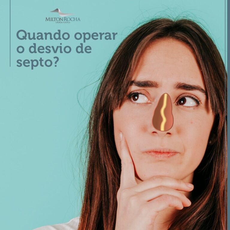 Leia mais sobre o artigo Cirurgia Plástica Recife | Quando operar o desvio de septo?