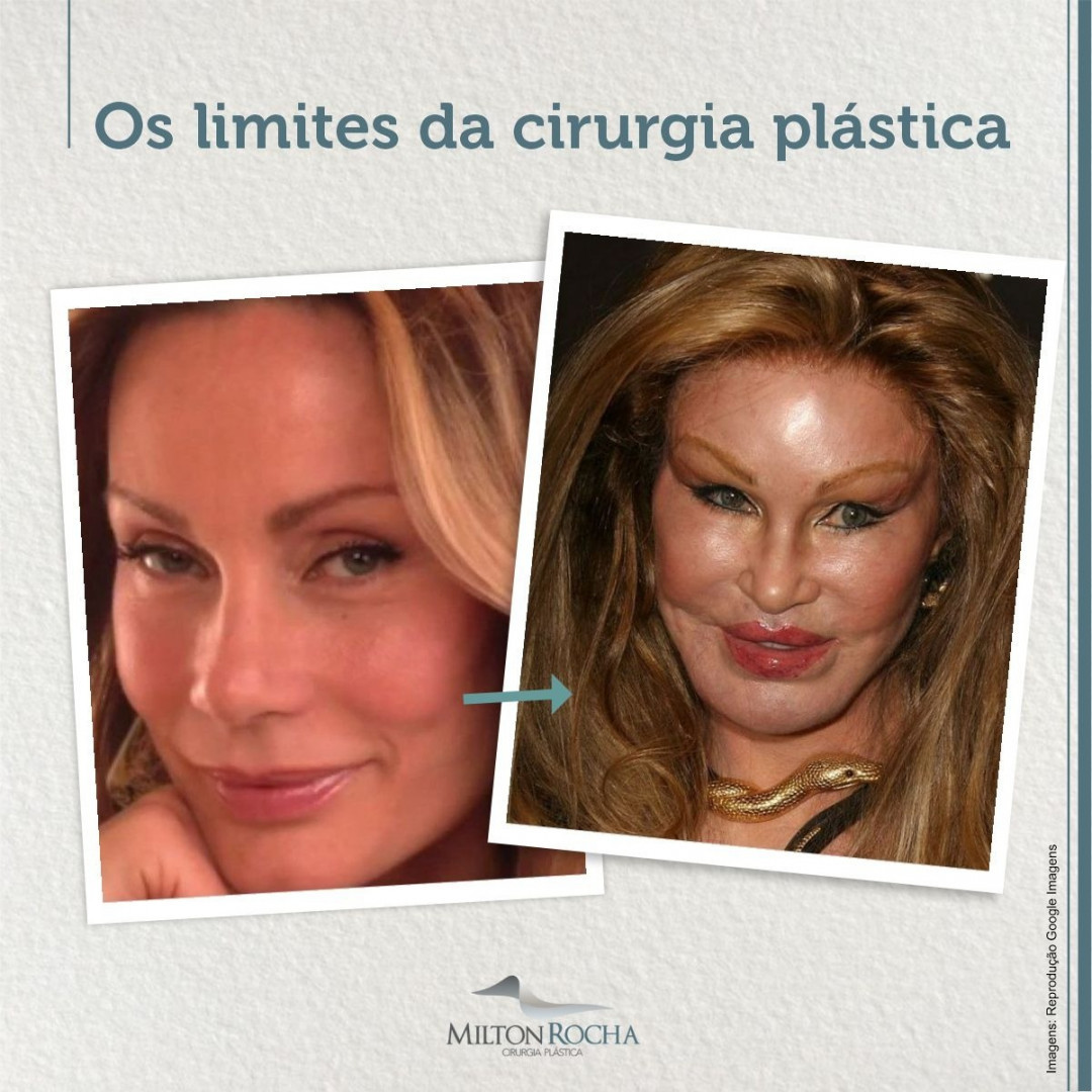 No momento, você está visualizando Cirurgia Plástica Recife | Os Limites da cirurgia plástica