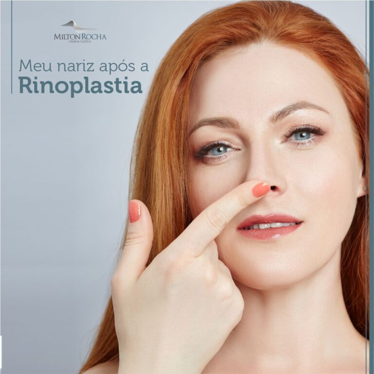 Leia mais sobre o artigo Meu nariz após a Rinoplastia