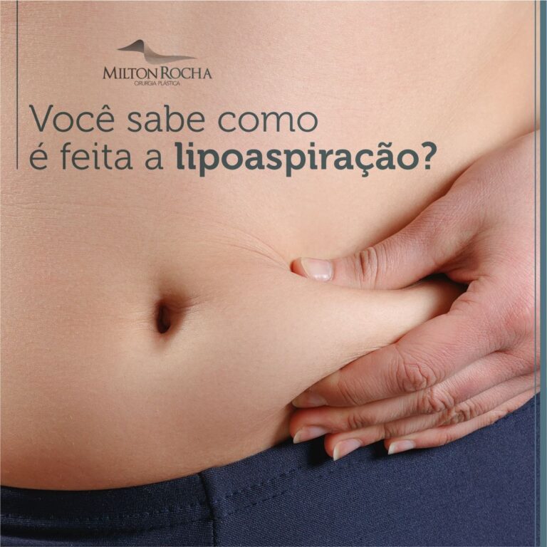 Leia mais sobre o artigo Cirurgia Plástica Recife – Você sabe como é feita a lipoaspiração?