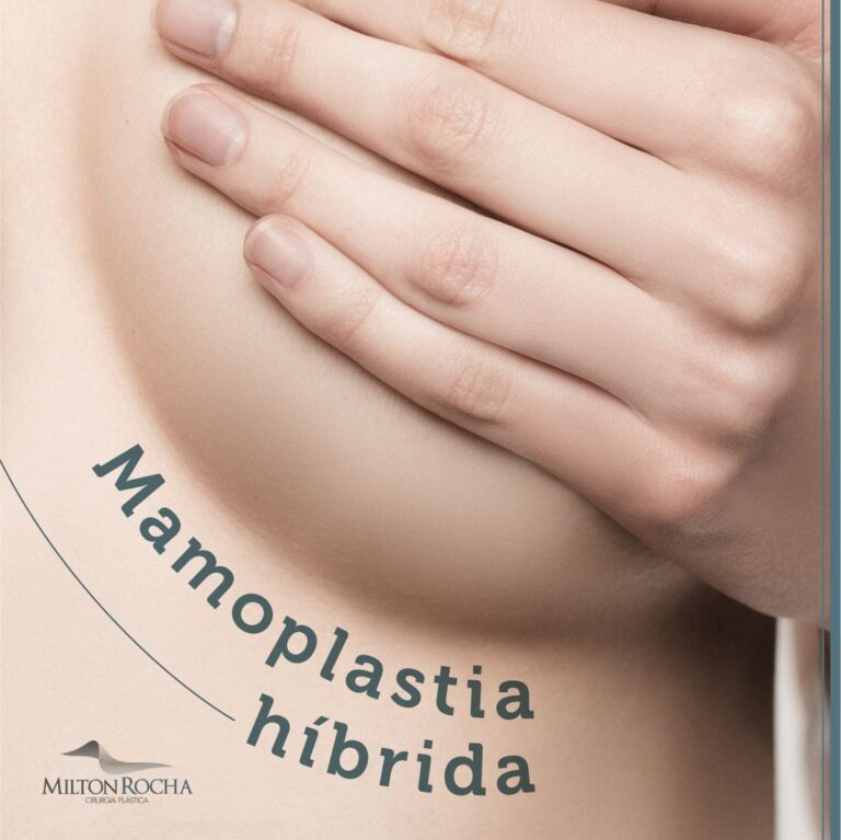 Leia mais sobre o artigo Cirurgia Plástica Recife – Mamoplastia híbrida