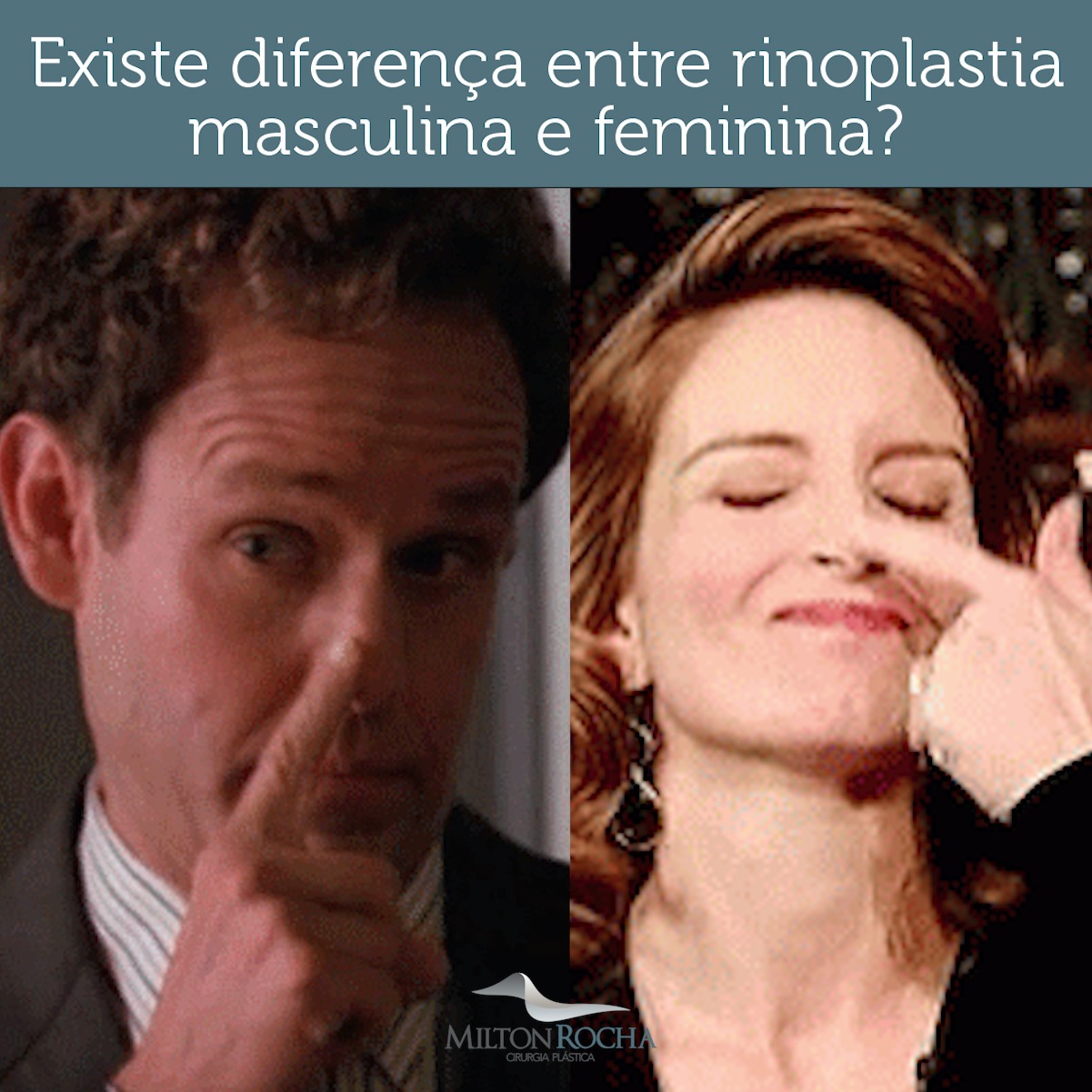 No momento, você está visualizando Cirurgia Plástica Recife – Existe diferença entre rinoplastia masculina e feminina?