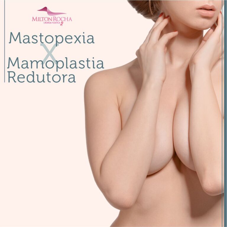 Leia mais sobre o artigo Cirurgia Plástica Recife – Mastopexia x Mamoplastia Redutora