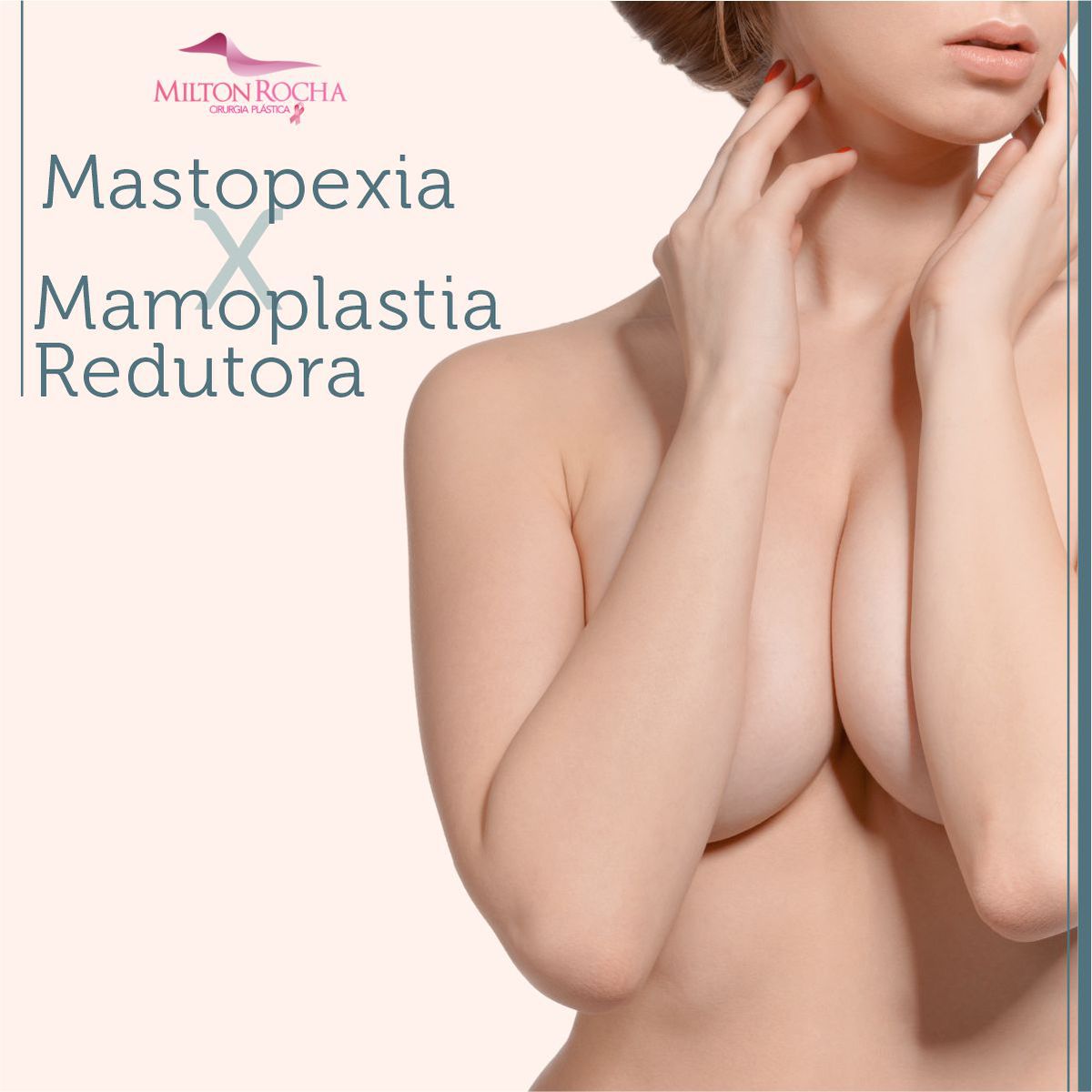 No momento, você está visualizando Cirurgia Plástica Recife – Mastopexia x Mamoplastia Redutora