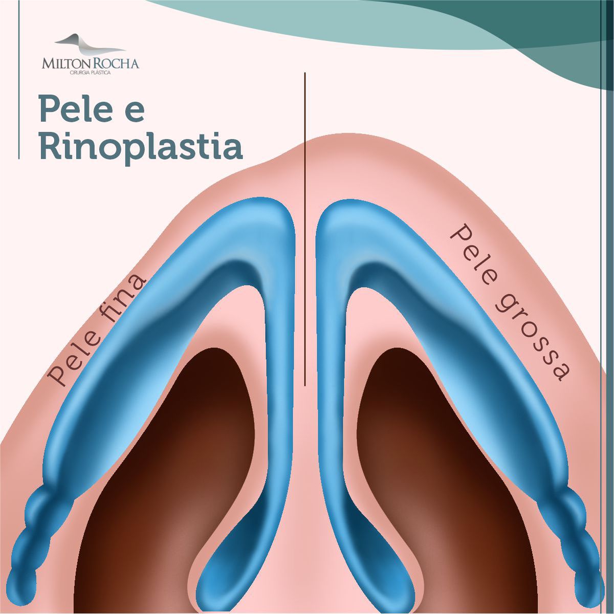 No momento, você está visualizando Cirurgia Plástica Recife – Pele e Rinoplastia