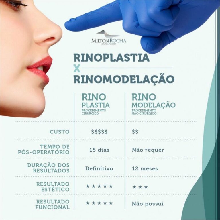 Leia mais sobre o artigo Cirurgia Plástica Recife – Rinoplastia x Rinomodelação.