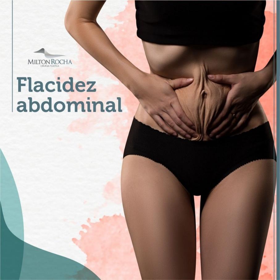 No momento, você está visualizando Cirurgia Plástica Recife – Flacidez abdominal