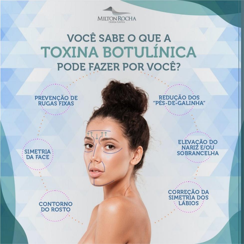 No momento, você está visualizando Cirurgia Plástica Recife – Você sabe o que a toxina butolinica pode fazer por você?