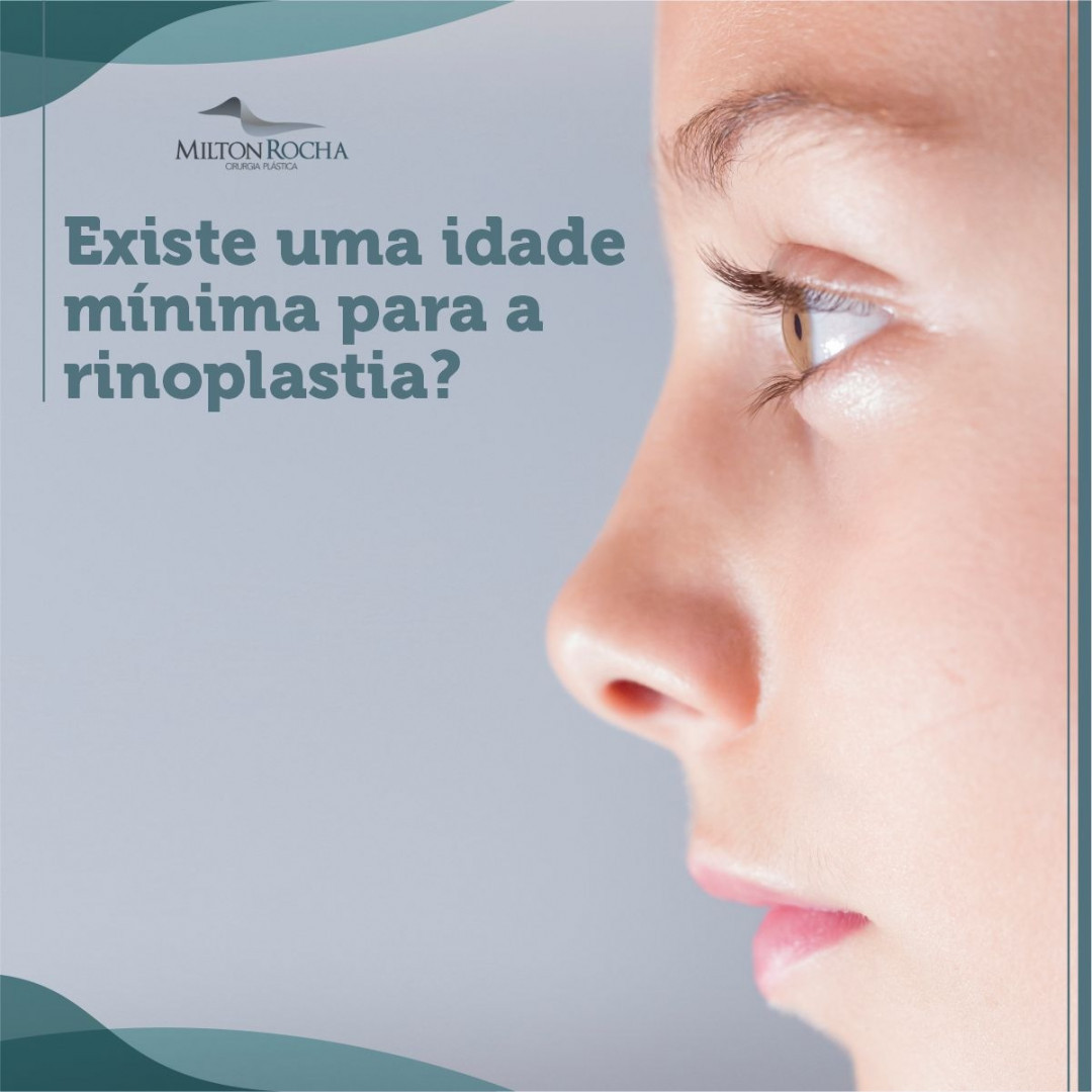 No momento, você está visualizando Cirurgia Plástica Recife – Existe uma idade mínima para a rinoplastia?