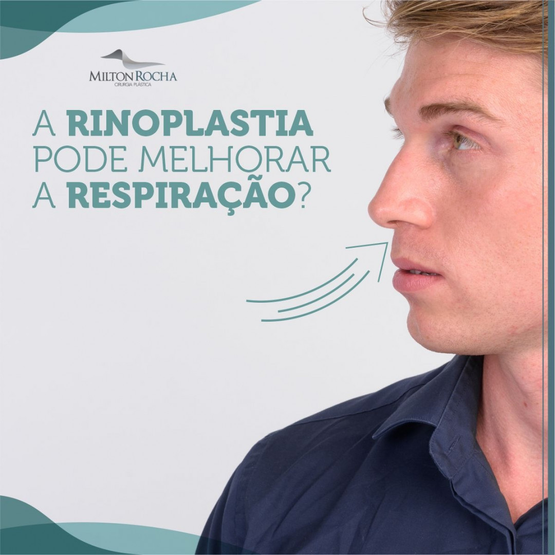 No momento, você está visualizando Cirurgia Plástica Recife – A rinoplastia pode melhorar a respiração?