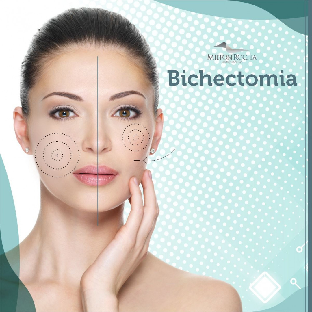 No momento, você está visualizando Cirurgia Plástica Recife – Bichectomia