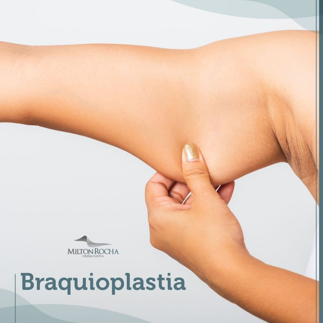 No momento, você está visualizando Cirurgia Plástica Recife – Braquioplastica