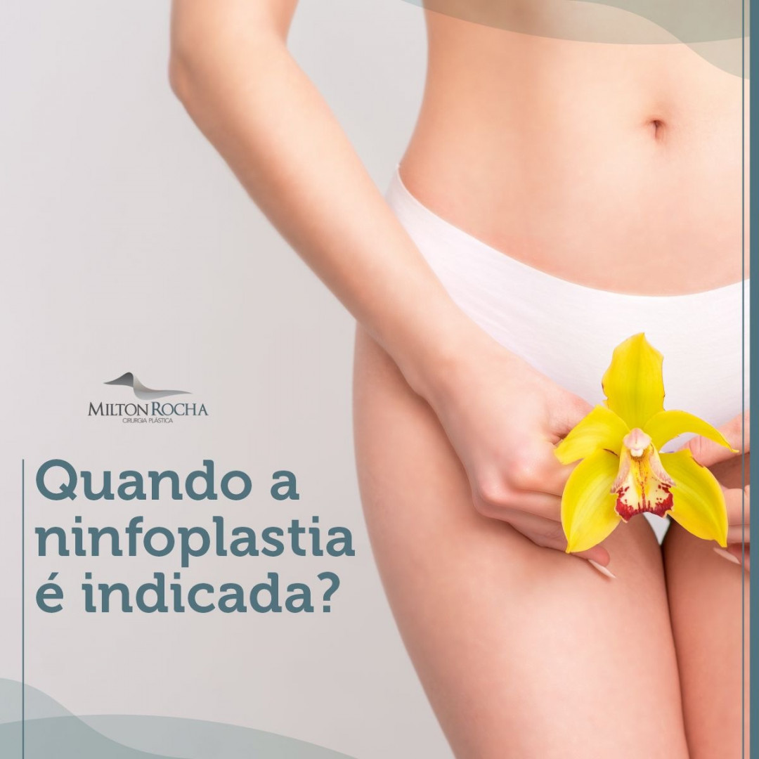 No momento, você está visualizando Cirurgia Plástica Recife – Quando a ninfoplastia é indicada?