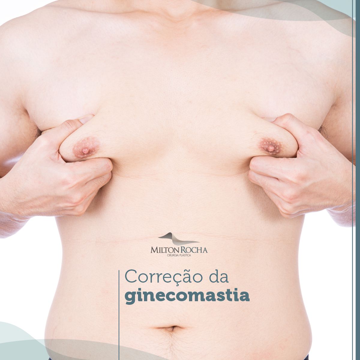 No momento, você está visualizando Cirurgia Plástica Recife – Correção da Ginecomastia
